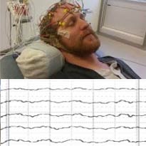 Photo of man undergoing EEG