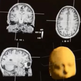 Brain 1