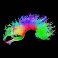 Brain injury concussion img 1