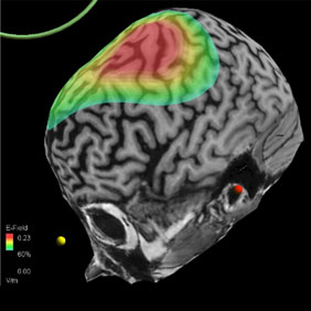 Brain2